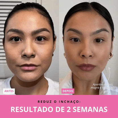 Aurea Glow™ | Rejuvenescedor Facial LED + Sérum GRÁTIS